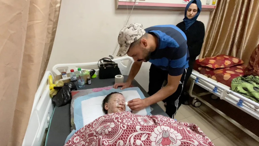 MSF: 70% of burn victims in Gaza are children, little chance of recovery