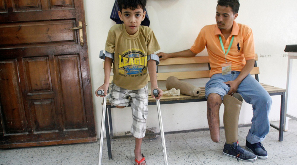 Saudi-funded hospitals in Yemen opt for amputation to eliminate costs 