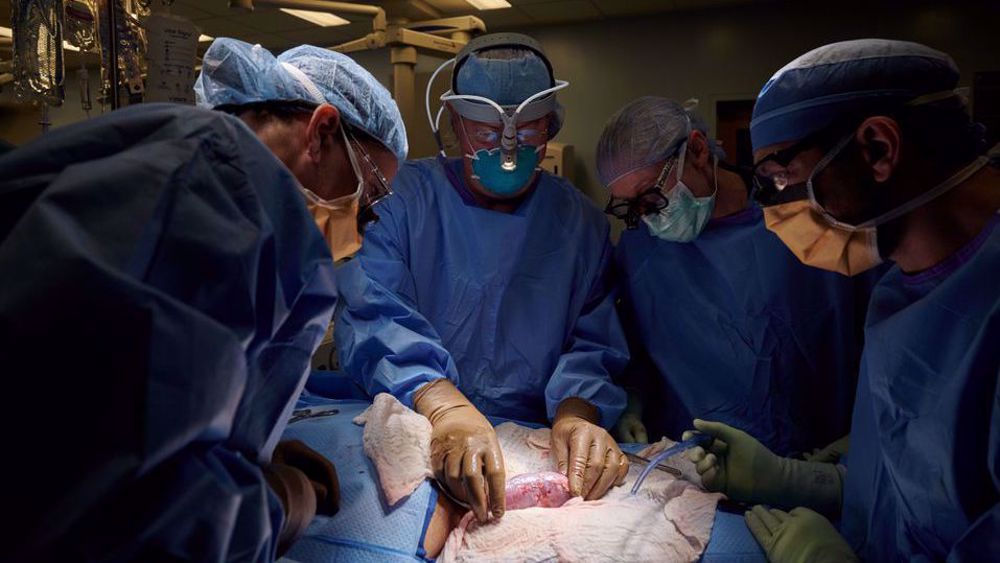 US surgeons successfully test pig kidney transplant in human patient
