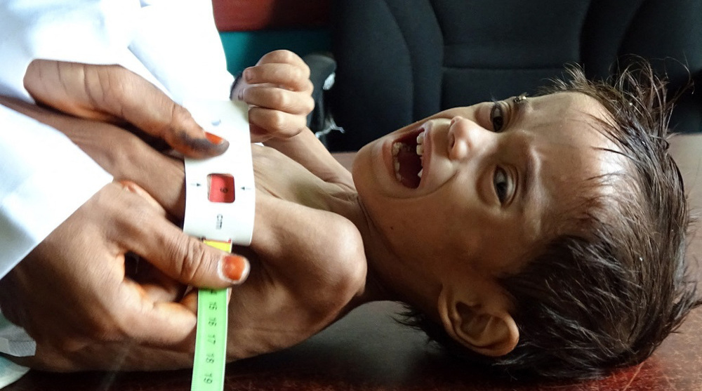 UN cuts food aid to Yemen due to lack of funds 