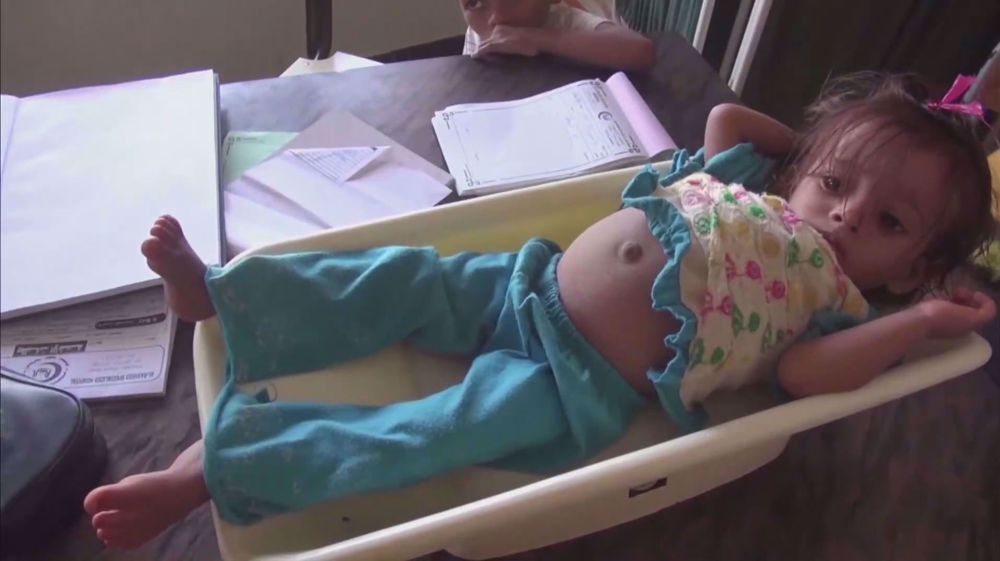 World Food Program cuts food aid to Yemen