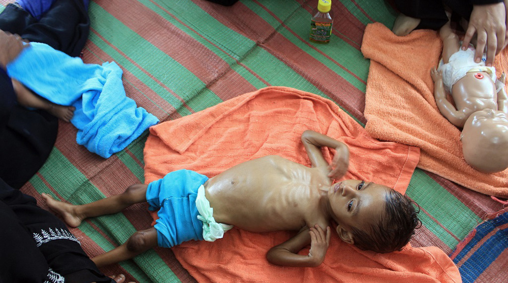 Yemen: UK arms used by Saudi-led aggressors deadlier than COVID-19