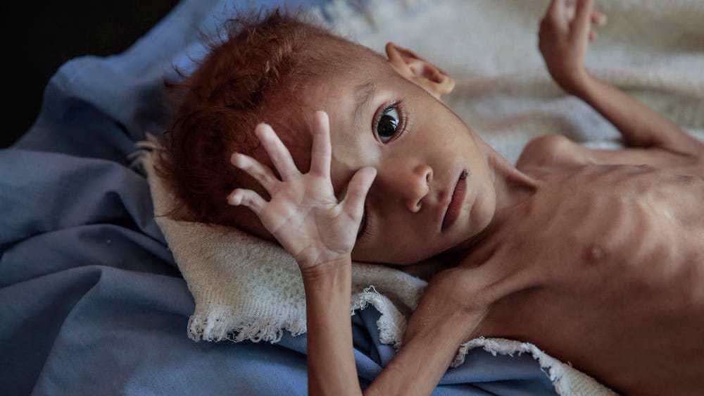 'No peace in sight unless Yemen siege lifted, foreign forces withdraw' 