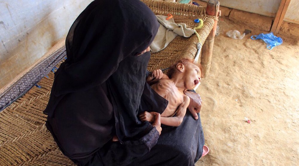 ‘US aid claims ridiculous; it would deprive Yemenis of oxygen if possible’