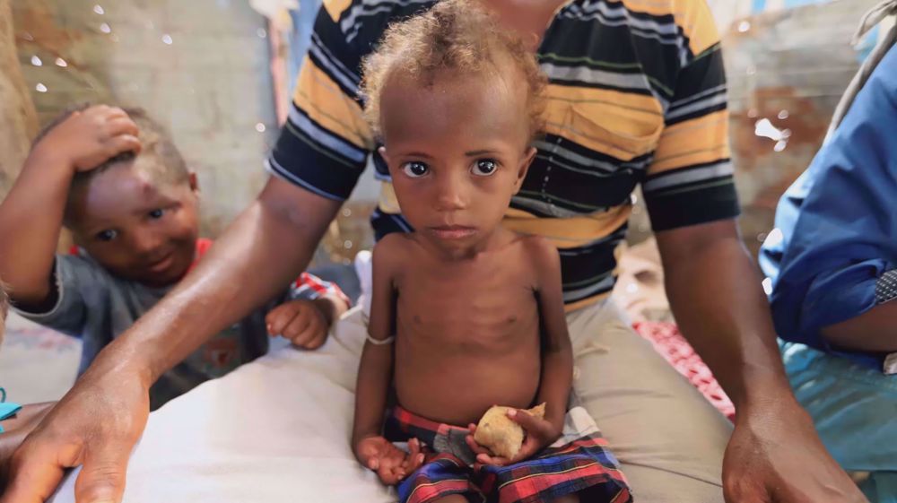 One Yemeni child dies every five minutes in the war-ravaged country