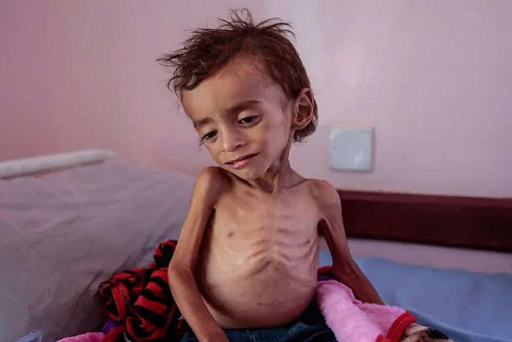 1 child dies 'every 10 minutes' in Yemen amid Saudi aggression 