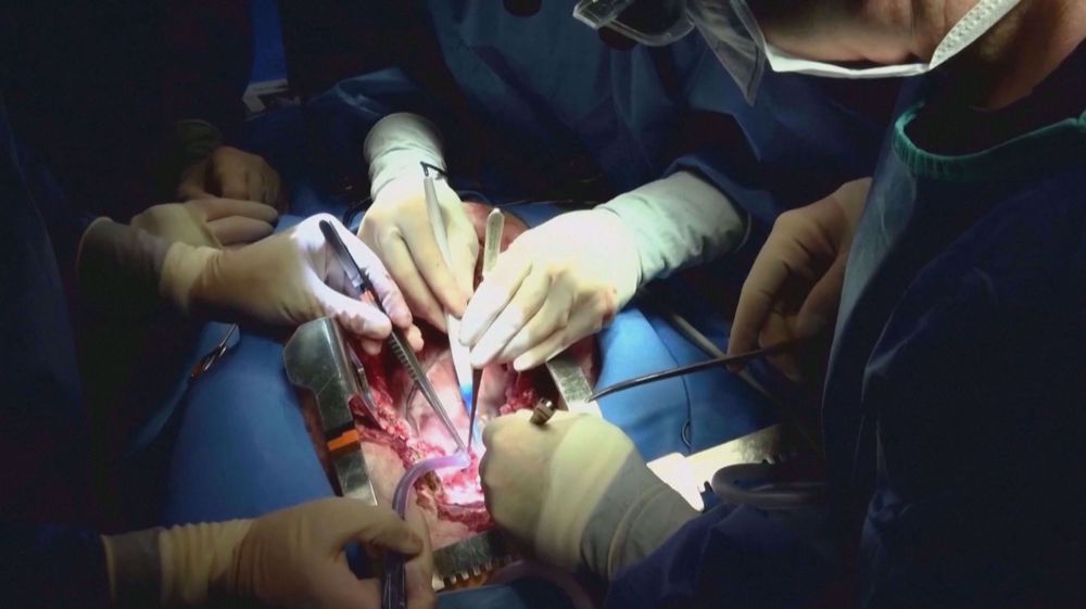 In a first, man gets heart transplant from genetically altered pig 