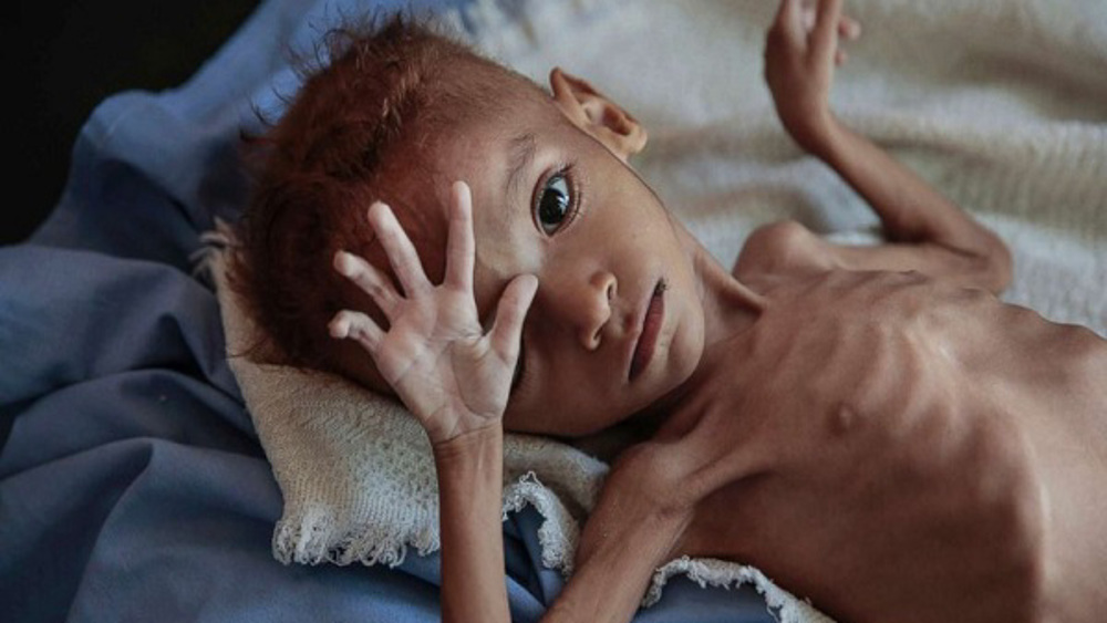 Aid groups warn US against blacklisting Yemen's Ansarullah   