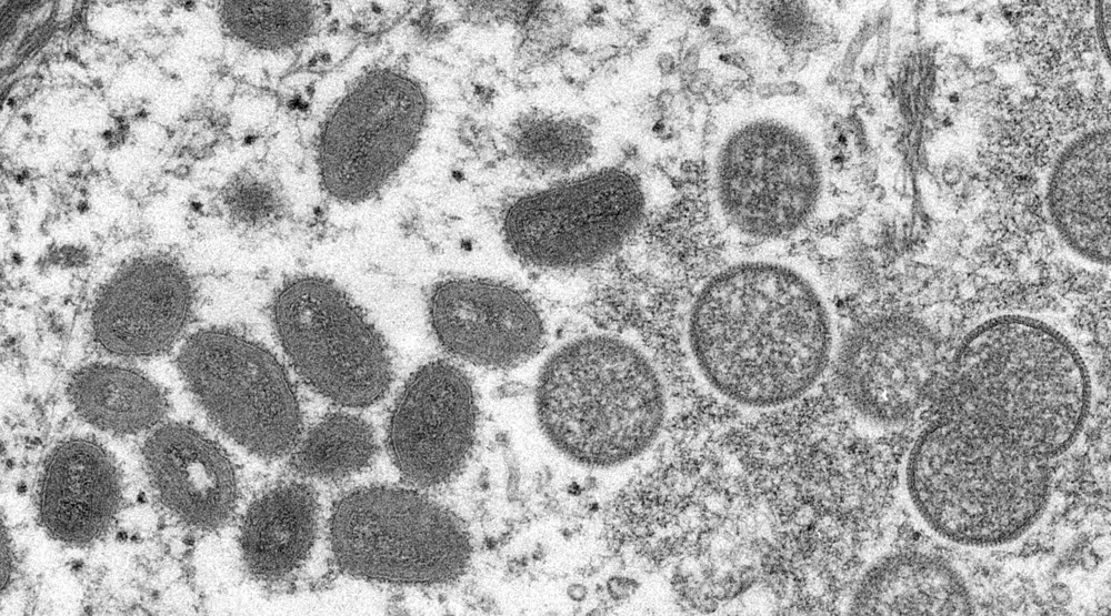 Russia: US labs in Nigeria responsible for monkeypox outbreak