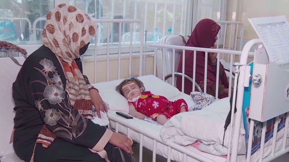 Afghanistan : des milliers d’enfants souffrent de malnutrition aiguë 