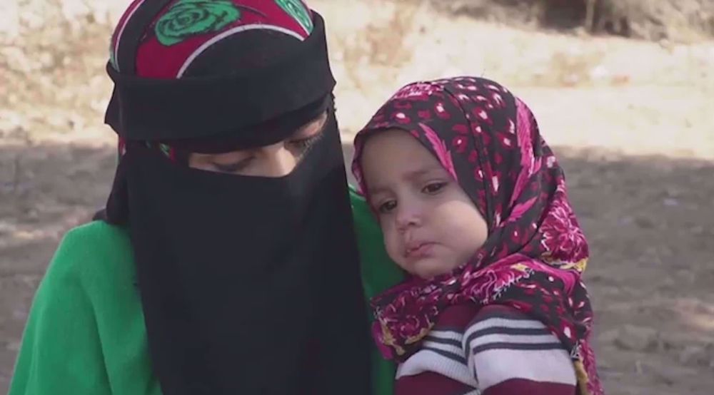 UN food agency ends its malnutrition prevention program in Yemen