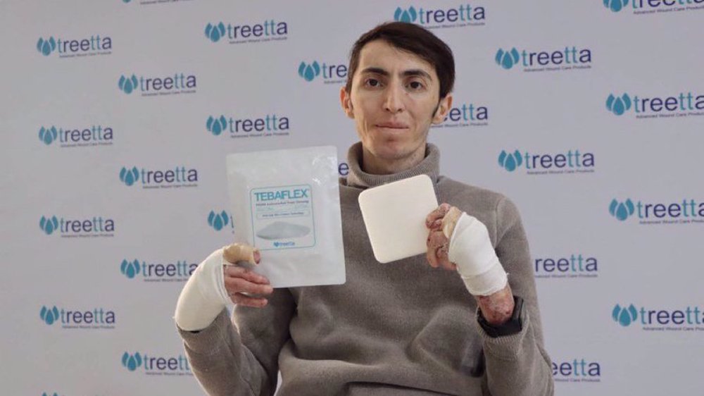Iranian firm produces wound dressings for rare skin disease amid sanctions