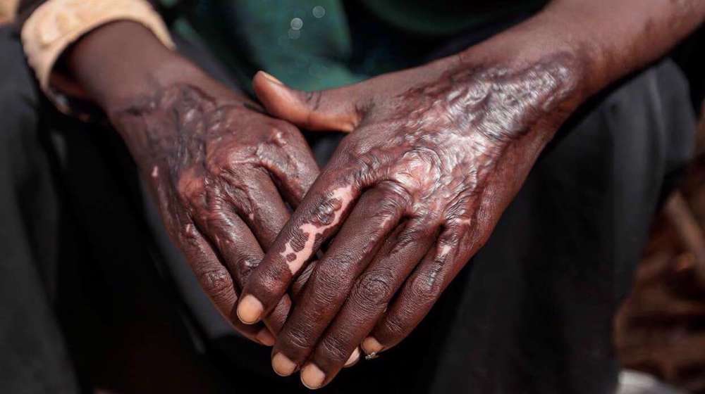 Soudan: un génocide est en cours (HRW)