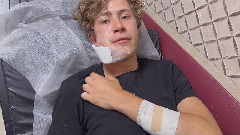 Israeli settlers attack, beat up foreign volunteers helping Palestinians in West Bank