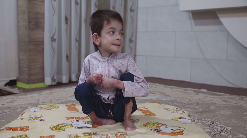 Documentary reveals reality of butterfly patients in Iran