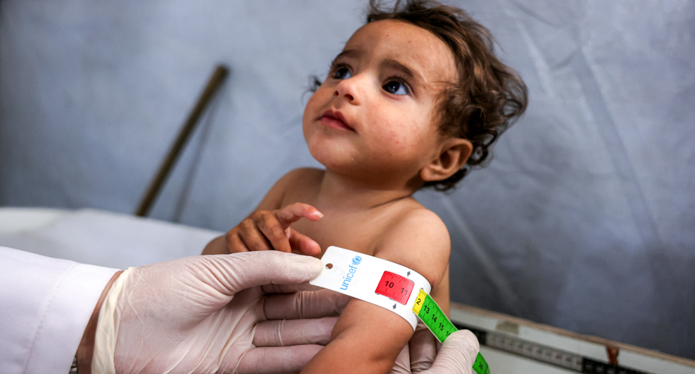 Over 65,000 children hospitalized for malnutrition as Israel starves Gaza
