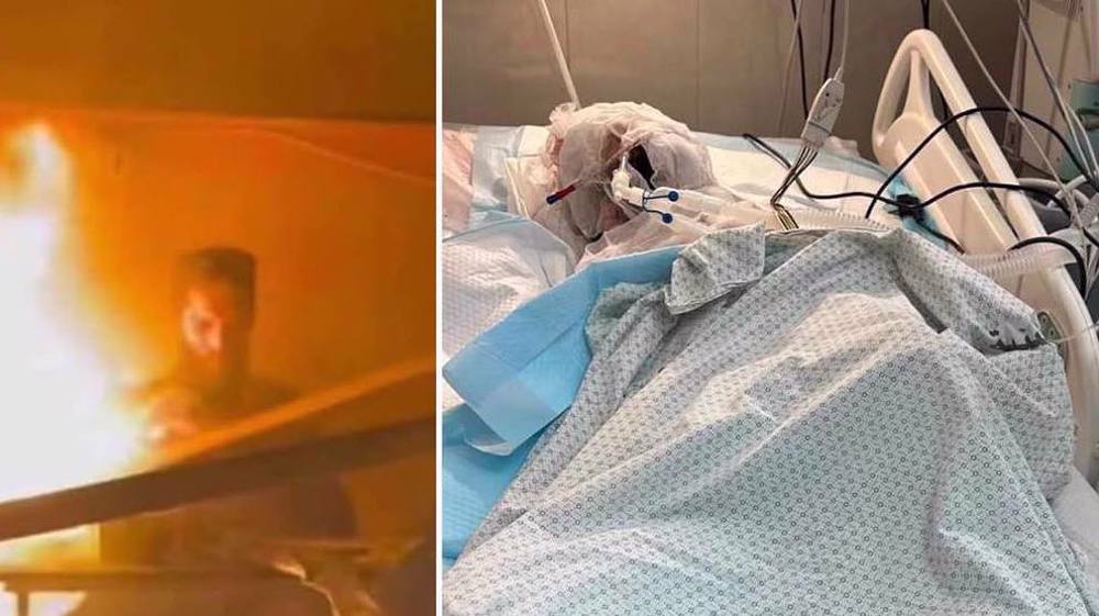 Un journaliste palestinien succombe à des brûlures subies lors d'une attaque israélienne