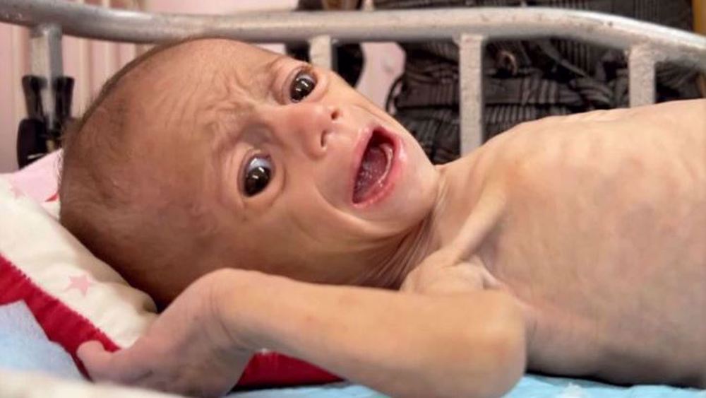  Gaza govt. demands ‘immediate end to famine’ imposed by Israel