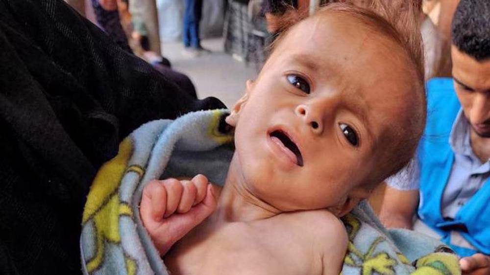 Israel killing over 500 Palestinian children monthly in Gaza: UN