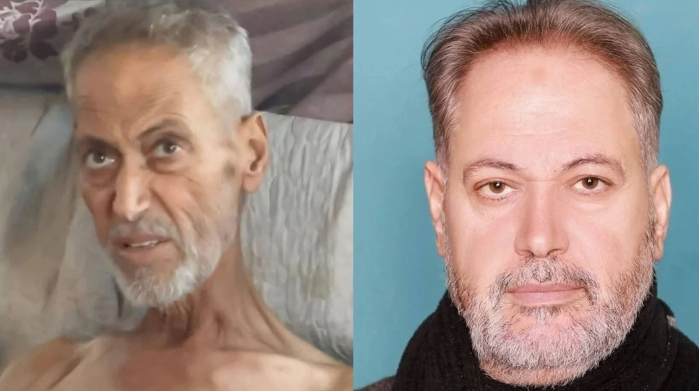 Renowned Palestinian academic succumbs to Israeli starvation in Gaza