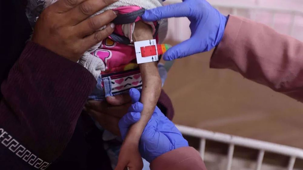 Gaza : les enfants meurent de malnutrition