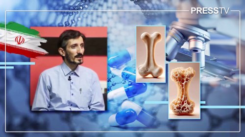 Farhad Bakhshi: Iranian innovator who turns bone-repair research into industrial production