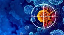 Iranian researchers develop new method to detect cancer from medical images