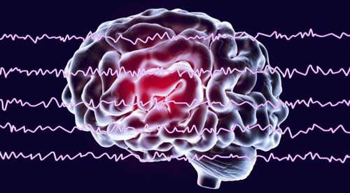 Iran develops smart device to measure depth of anesthesia using EEG, brain modeling