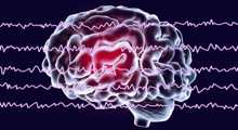 Iran develops smart device to measure depth of anesthesia using EEG, brain modeling