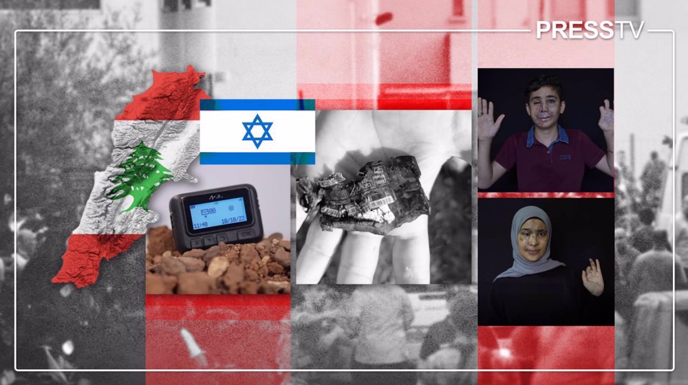 Two years after Israel’s pager terrorism in Lebanon: Scars, loss, and the will to carry on