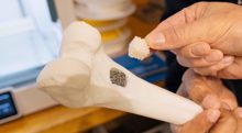 University of Tehran scientists develop bio-scaffolds for bone repair