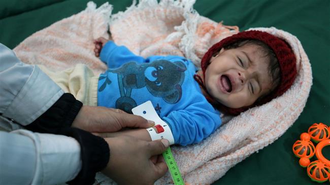 UN doing nothing to save Yemen: Journalist