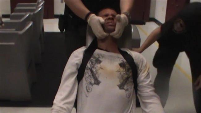 Black man pepper-sprayed strapped in chair in US