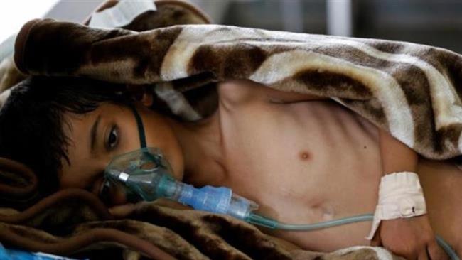 UN Security Council meets on Yemen