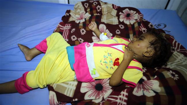 EU calls for total lifting of Saudi blockade on Yemen