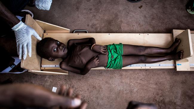 400,000 children in Congo could die of hunger: UN