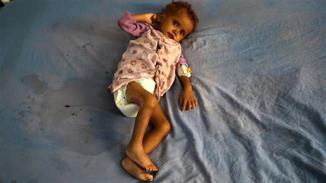 Yemen: Oxfam slams ‘medieval’ Saudi-led blockade