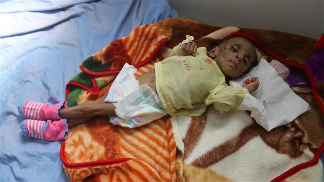 Saudi Yemen siege violates US law: Trump nominee