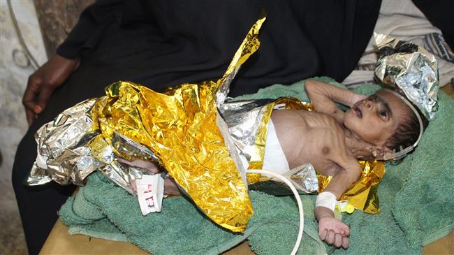 ‘Over 7 million Yemeni kids face serious famine threat’