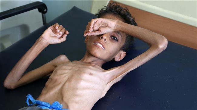 Trump's allies in Congress block Yemen war vote