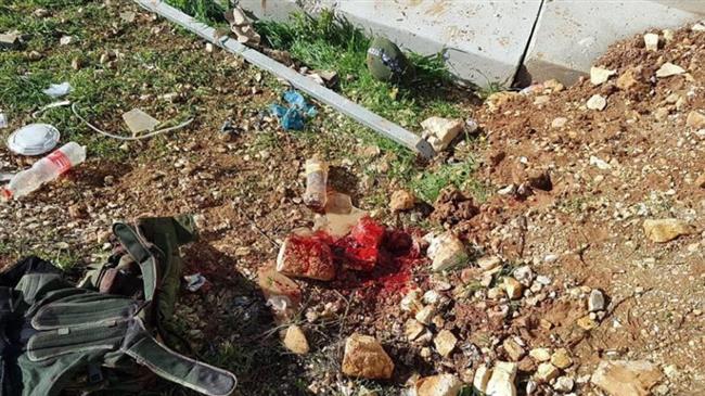 Israeli soldier seriously wounded in stone-throwing incident