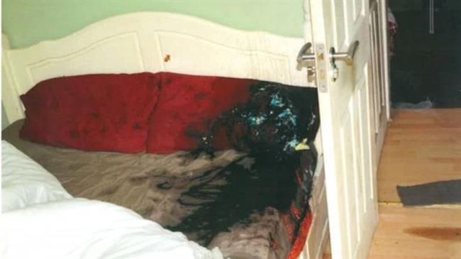 UK acid attack victim sues police over lack of action