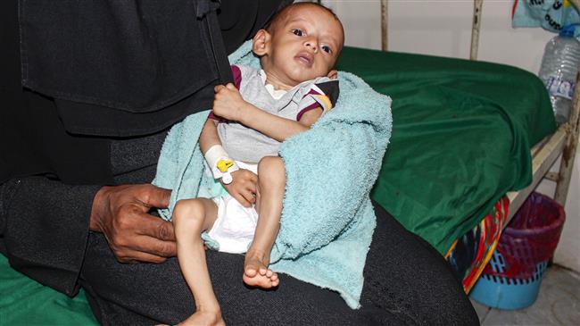 Worsening world hunger affects 821 million: UN