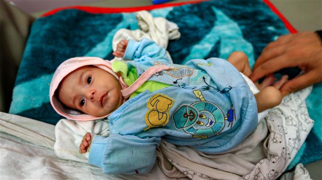 50,000 Yemeni kids die every year amid Saudi war: Ansarullah 