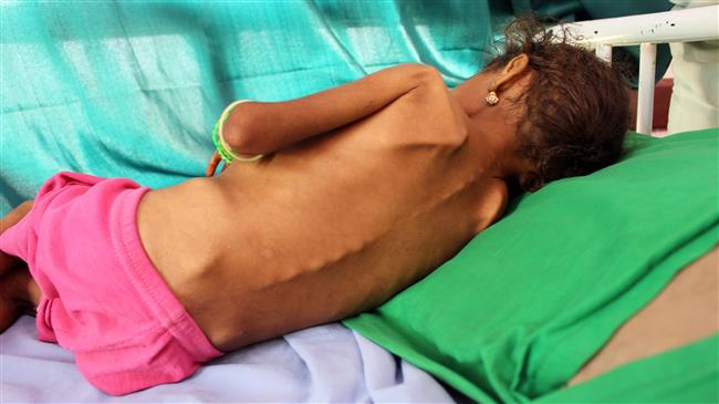 ‘Yemenis aren’t going hungry, they’re starving:’ UN issues solemn warning