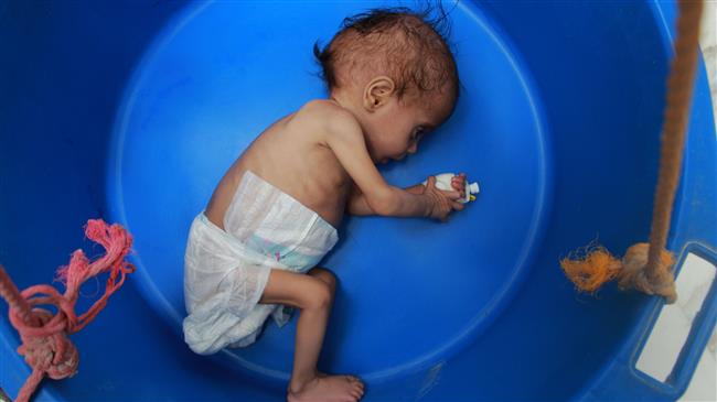Life of 100,000 Yemeni kids at risk as country slides further into sorrow
