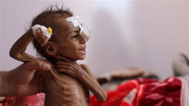 UN Security Council contributed to Yemen conflict: Commentator