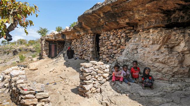 UN: Malnutrition in conflict-hit Yemen hitting record levels